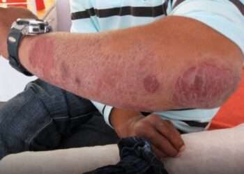 𝐄𝐌𝐄𝐑𝐆𝐄𝐍𝐂𝐈𝐀 𝐄𝐍 𝐐𝐔𝐈𝐍𝐓𝐀𝐍𝐀 𝐑𝐎𝐎. 𝐋𝐀 𝐋𝐄𝐏𝐑𝐀 𝐑𝐄𝐆𝐑𝐄𝐒𝐀 𝐂𝐎𝐍 𝐅𝐔𝐄𝐑𝐙𝐀 𝐘 𝐀𝐌𝐄𝐍𝐀𝐙𝐀 𝐄𝐍 𝐒𝐈𝐋𝐄𝐍𝐂𝐈𝐎 𝐀 𝐂𝐀𝐍𝐂Ú𝐍